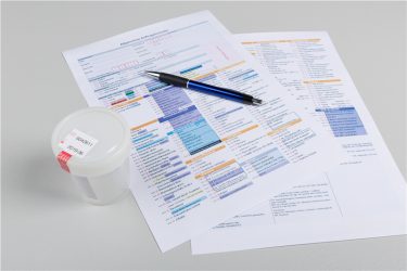 ヒュナーテストで「精子がない」!?どうしたらいいでしょうか【医師監修】