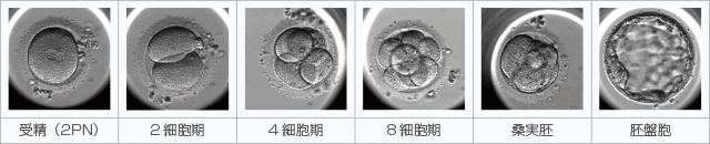 成長の遅い受精卵を 移植すると障害の確率が 高くなるのでしょうか 医師監修 ジネコ不妊治療情報