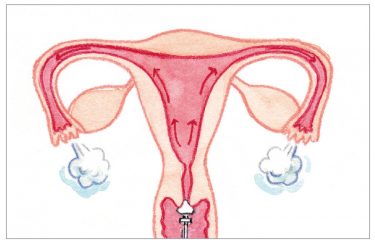 卵管造影と卵管通水検査。検査の痛みと通りの関係は？検査後は妊娠しやすくなる？