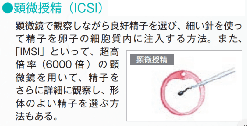 不妊治療はじめて講座⑥最終回【医師監修】│【医師監修】ジネコ