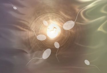 夫が非閉塞性無精子症です。ホルモン療法＋MD-TESEで精子が回収できる可能性は？【医師監修】