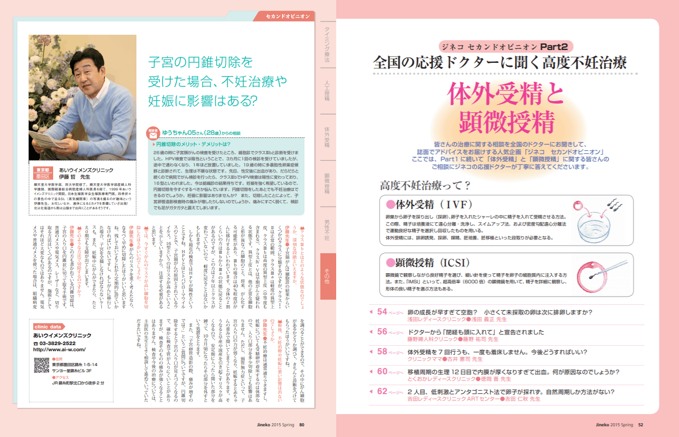 円錐切除のメリット デメリットは 医師監修 ジネコ不妊治療情報