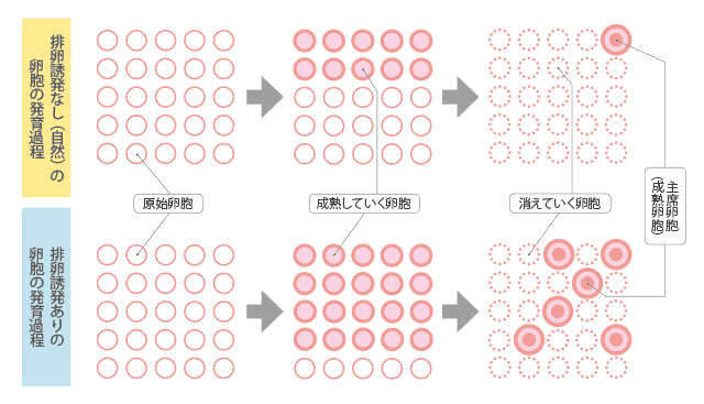 「排卵誘発剤」って何?│【医師監修】ジネコ不妊治療情報