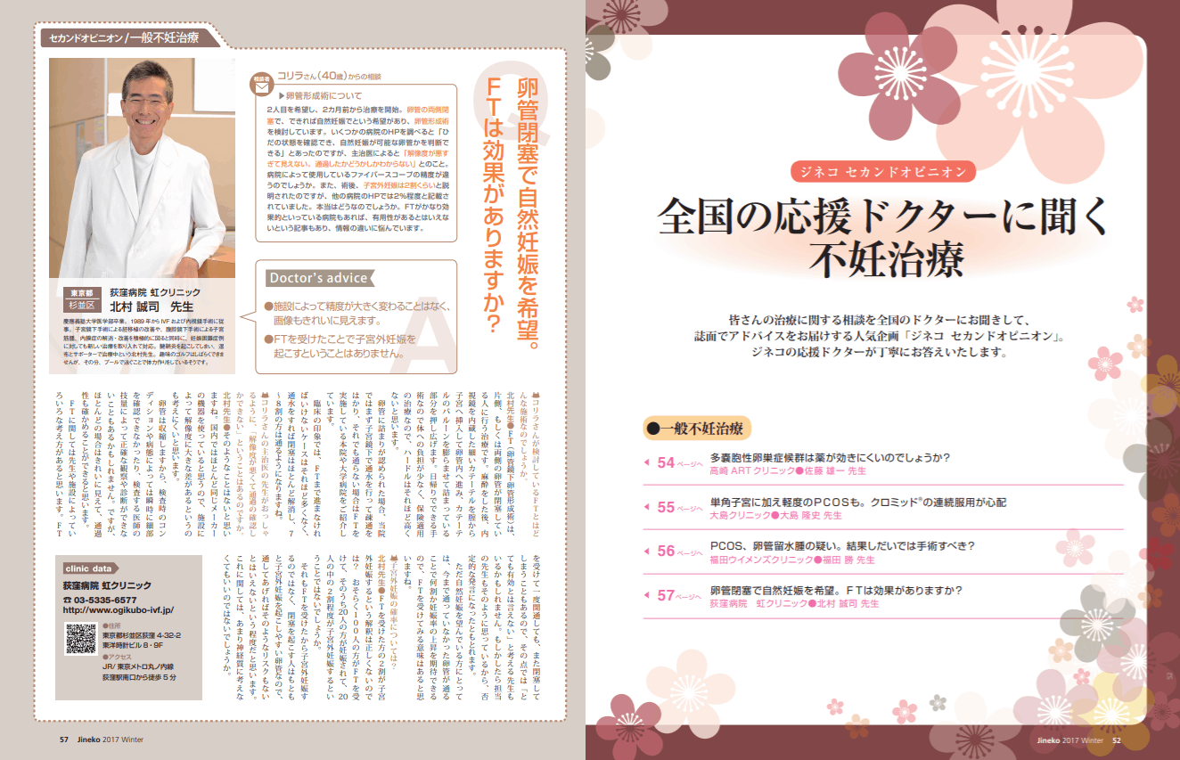 卵管形成術について 医師監修 ジネコ不妊治療情報