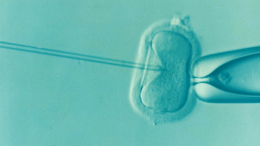 翌日のレスキューＩＣＳＩの胚盤胞について