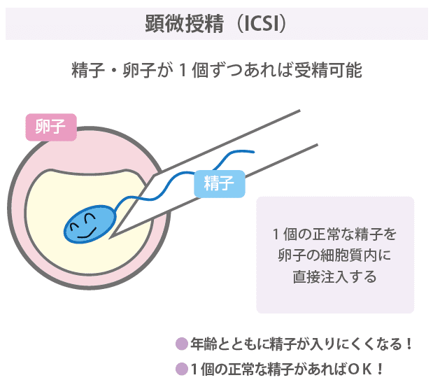 新品　エキスパートによる生殖領域の外科的手法 ‐生殖内視鏡と不妊治療のコツ エキスパートによる生殖領域の外科的手法 ‐生殖内視鏡と不妊治療
