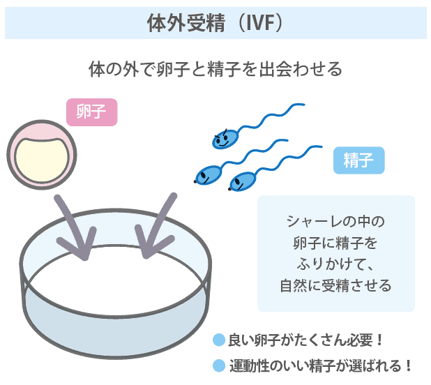 新品　エキスパートによる生殖領域の外科的手法 ‐生殖内視鏡と不妊治療のコツ エキスパートによる生殖領域の外科的手法 ‐生殖内視鏡と不妊治療